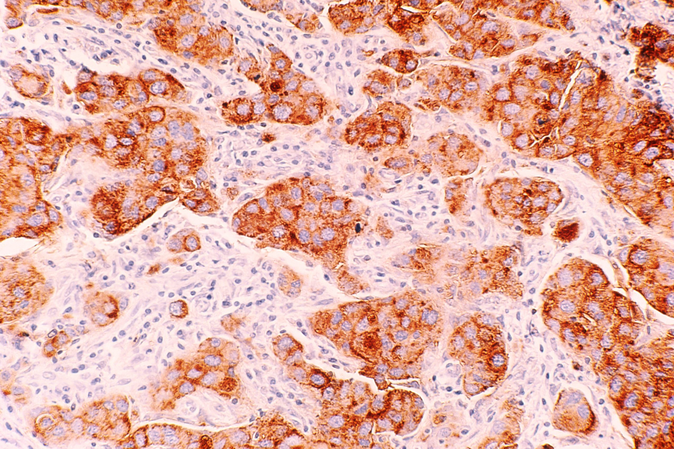national-cancer-institute-i-f4ibaatla-unsplash-scaled-6709761